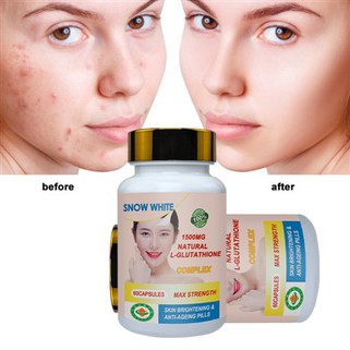 এল গ্লুটাথিয়ন ব্রাইটনিং ক্যাপসুল